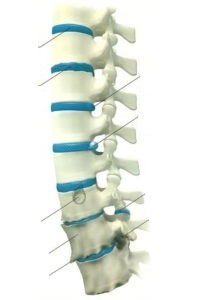 tratamentul osteocondrozei lombare a coloanei vertebrale